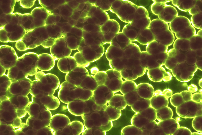 Ilustrasi Bakteri (Foto: pixabay)