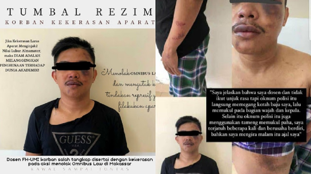 Dosen UMI Makassar Dipukul dan Diseret Polisi