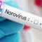 Wabah Norovirus Bangkit Di China, Sejumlah Mahasiwa Yang Terinfeksi Penuhi Rumah Sakit Hingga Asrama