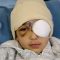 Malek Issa, bocah 9 tahun asal Palestina kehilangan mata kirinya